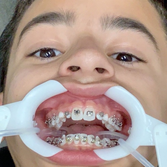 Meet your Posher, Sebastian - Picture 1 of 1